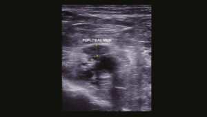 Figure 18