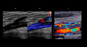 Figure 19