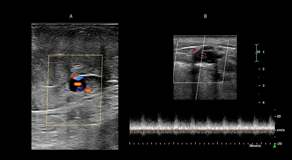 Figure 21