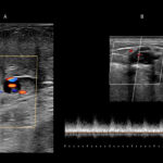 Figure 21