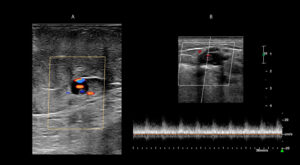 Figure 21