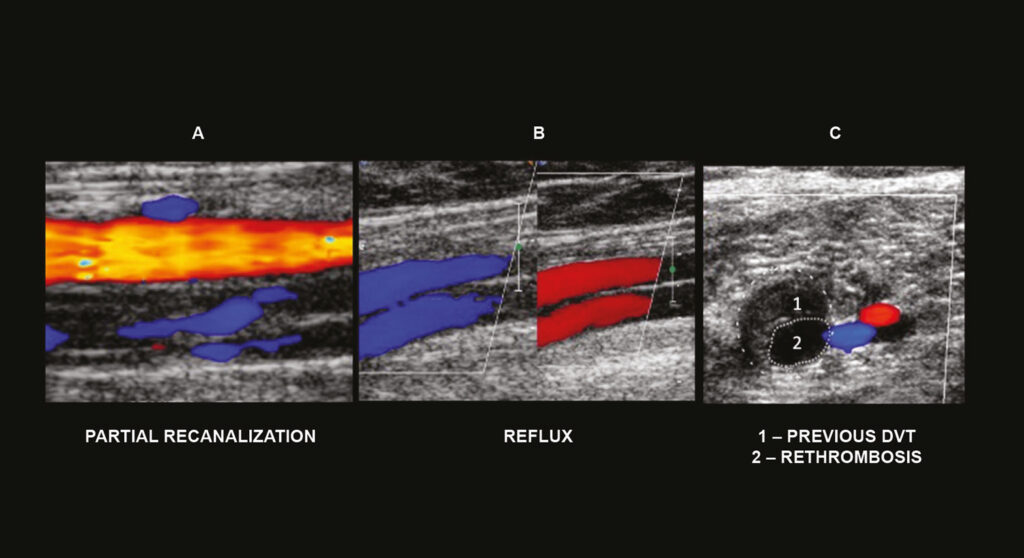 Figure 22