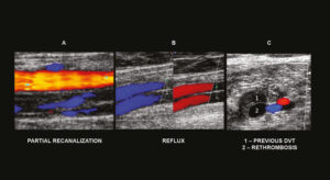 Figure 22