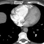Figure 23