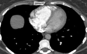 Figure 23