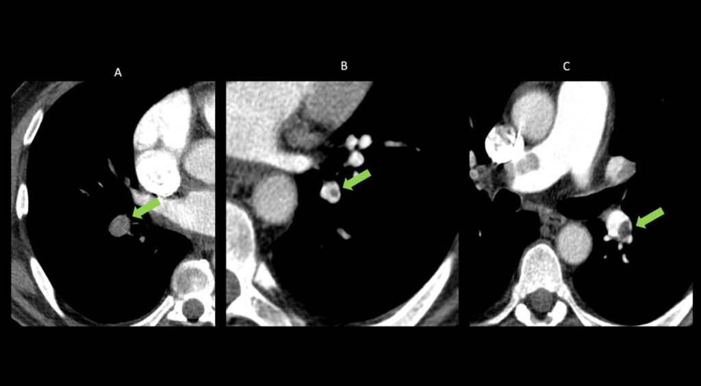 Figure 25