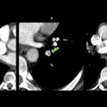 Figure 25