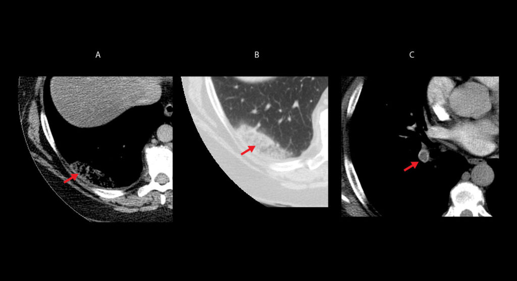 Figure 26