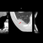 Figure 26
