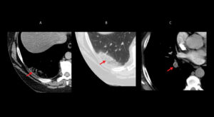 Figure 26