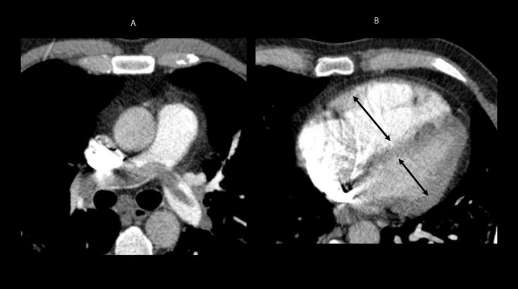 Figure 27