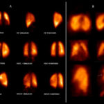 Figure 28