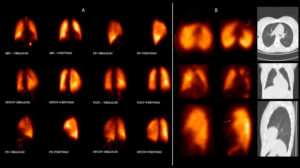 Figure 28