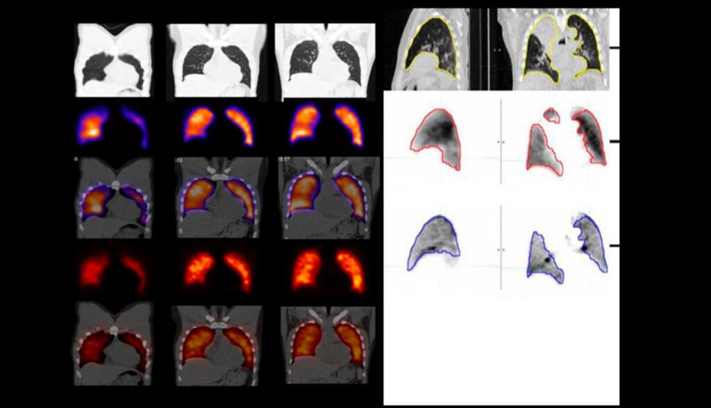 Figure 29