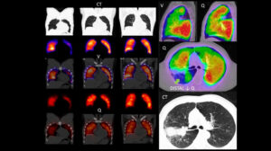 Figure 30