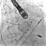 Figura 4