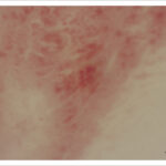 Figura 3