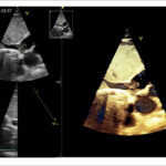 Figura 1