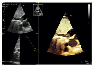 Figura 1