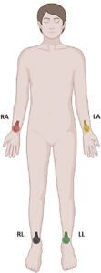 Figure 2.1