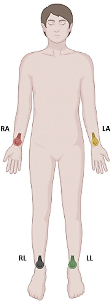 Figure 2.1