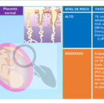 Figura 4.10