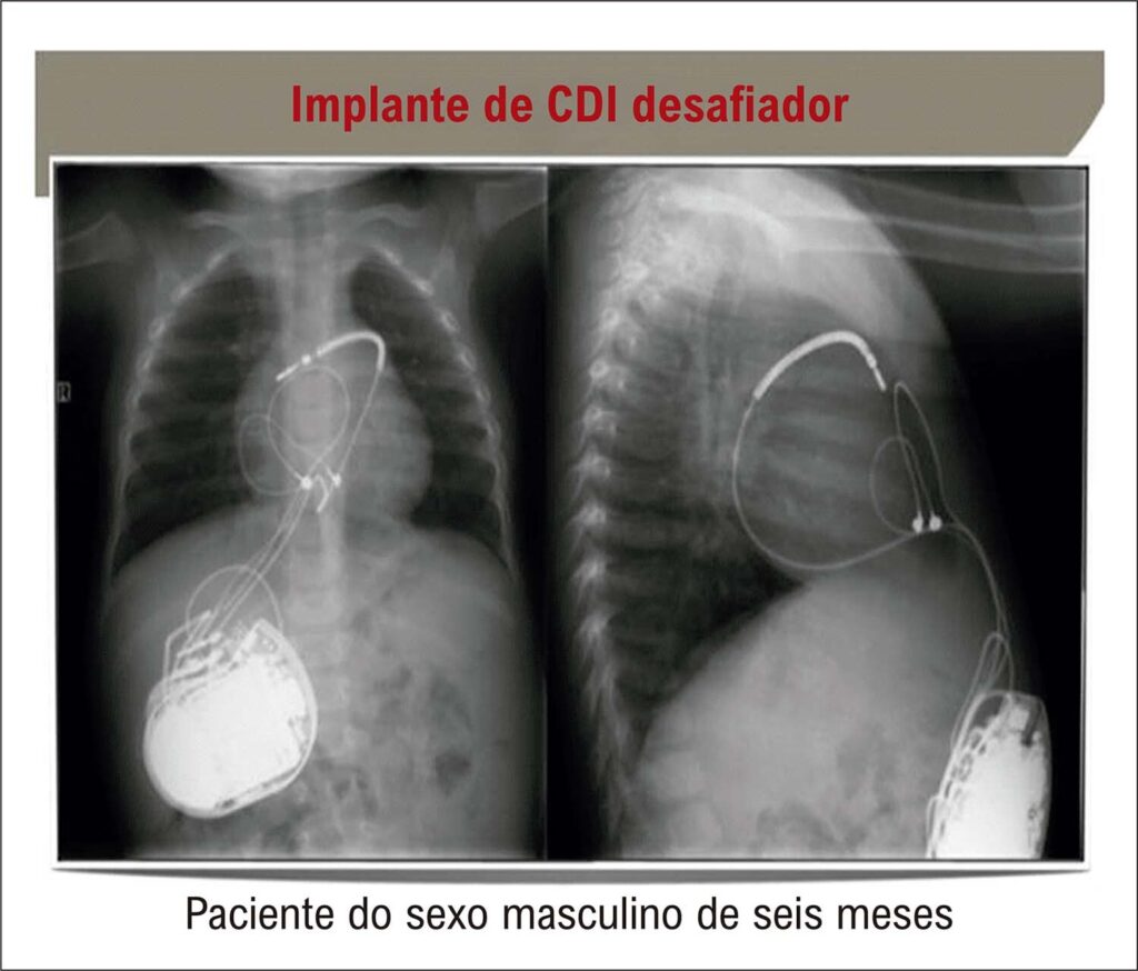Figura 3