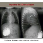 Figura 3