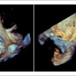Figura 2