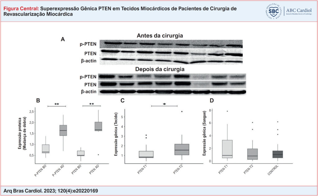 Resultados de expressão gênica e Western Blot de pacientes com DAC. Imagens de membrana dos níveis de proteína PTEN e P-PTEN determinados por anticorpos específicos em tecidos miocárdicos de pacientes do sexo feminino/masculino (A). Achados de expressão proteica de PTEN e P-PTEN em tecido miocárdico retirado de pacientes antes e após a cirurgia. A β-actina foi usada como controle de carregamento (B). A expressão gênica do PTEN foi determinada por PCR quantitativo em tempo real (qRT-PCR) em tecidos miocárdicos retirados de pacientes em 2 momentos diferentes (C). A expressão gênica do PTEN foi determinada por PCR quantitativo em tempo real (qRT-PCR) em amostras de sangue colhidas de pacientes em 2 momentos diferentes e em amostras de sangue de controle (D). Comparações: P-PTEN AC vs. P-PTEN DC, PTEN AC vs. PTEN DC, e PTEN-T1 vs. PTEN-T2 (em amostras de sangue e tecido separadamente) via teste Wilcoxon Signed Rand; PTEN-T1 vs. Controle e PTEN-T2 vs. Controle via teste U de Mann-Whitney (*p<0,05, **p<0,001). (T1: antes da circulação extracorpórea, T2: depois da circulação extracorpórea).