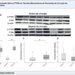 Resultados de expressão gênica e Western Blot de pacientes com DAC. Imagens de membrana dos níveis de proteína PTEN e P-PTEN determinados por anticorpos específicos em tecidos miocárdicos de pacientes do sexo feminino/masculino (A). Achados de expressão proteica de PTEN e P-PTEN em tecido miocárdico retirado de pacientes antes e após a cirurgia. A β-actina foi usada como controle de carregamento (B). A expressão gênica do PTEN foi determinada por PCR quantitativo em tempo real (qRT-PCR) em tecidos miocárdicos retirados de pacientes em 2 momentos diferentes (C). A expressão gênica do PTEN foi determinada por PCR quantitativo em tempo real (qRT-PCR) em amostras de sangue colhidas de pacientes em 2 momentos diferentes e em amostras de sangue de controle (D). Comparações: P-PTEN AC vs. P-PTEN DC, PTEN AC vs. PTEN DC, e PTEN-T1 vs. PTEN-T2 (em amostras de sangue e tecido separadamente) via teste Wilcoxon Signed Rand; PTEN-T1 vs. Controle e PTEN-T2 vs. Controle via teste U de Mann-Whitney (*p<0,05, **p<0,001). (T1: antes da circulação extracorpórea, T2: depois da circulação extracorpórea).