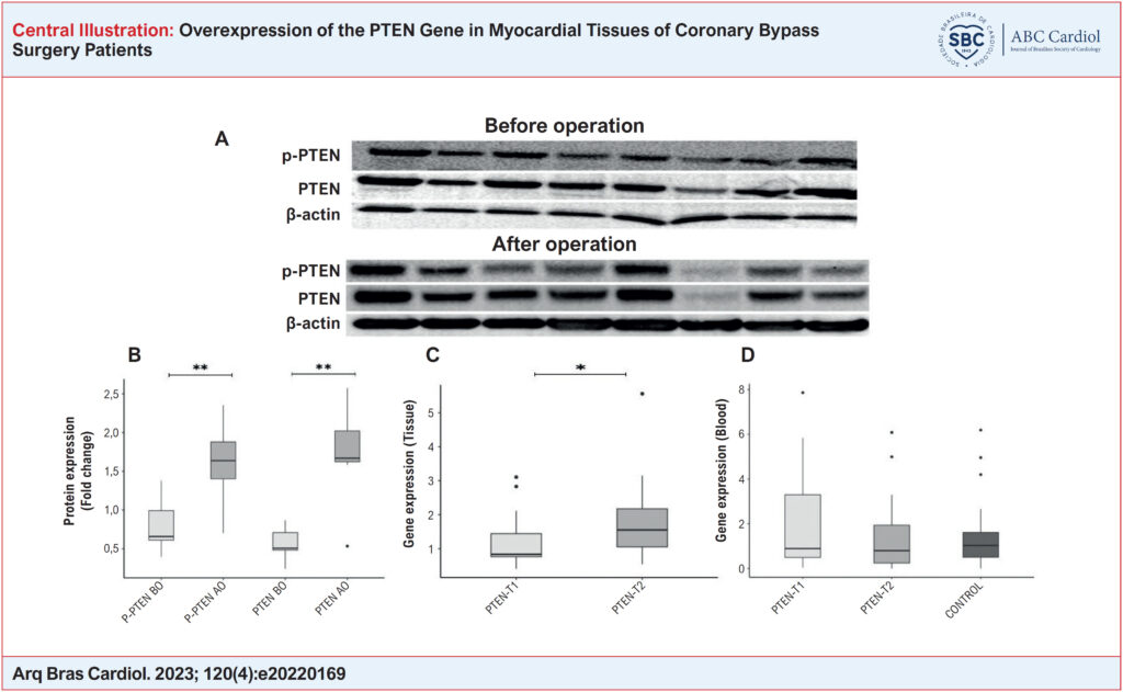 Gene expression and western blot results of the patients with CAD. Membrane images of PTEN and P-PTEN protein levels determined using specific antibodies in myocardial tissues of female/male patients (A). PTEN and P-PTEN protein expression findings in myocardial tissue taken from patients before and after surgery. β-actin was used as a loading control (B). The expression of the PTEN gene was determined by quantitative real-time PCR (qRT-PCR) in myocardial tissues taken from patients at 2 different times (C). Expression of the PTEN gene was determined by quantitative real-time PCR (qRT-PCR) in blood samples taken from patients at 2 different times and in control blood samples (D). Comparisons: P-PTEN BO vs. P-PTEN AO, PTEN BO vs. PTEN AO, and PTEN-T1 vs. PTEN-T2 (in blood and tissue samples separately) via Wilcoxon Signed Rand test; PTEN-T1 vs. Control and PTEN-T2 vs. Control via Mann-Whitney U test (*p<0.05, **p<0.001). (T1: before cardiopulmonary bypass, T2: after cardiopulmonary bypass).