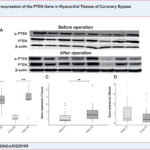 Gene expression and western blot results of the patients with CAD. Membrane images of PTEN and P-PTEN protein levels determined using specific antibodies in myocardial tissues of female/male patients (A). PTEN and P-PTEN protein expression findings in myocardial tissue taken from patients before and after surgery. β-actin was used as a loading control (B). The expression of the PTEN gene was determined by quantitative real-time PCR (qRT-PCR) in myocardial tissues taken from patients at 2 different times (C). Expression of the PTEN gene was determined by quantitative real-time PCR (qRT-PCR) in blood samples taken from patients at 2 different times and in control blood samples (D). Comparisons: P-PTEN BO vs. P-PTEN AO, PTEN BO vs. PTEN AO, and PTEN-T1 vs. PTEN-T2 (in blood and tissue samples separately) via Wilcoxon Signed Rand test; PTEN-T1 vs. Control and PTEN-T2 vs. Control via Mann-Whitney U test (*p<0.05, **p<0.001). (T1: before cardiopulmonary bypass, T2: after cardiopulmonary bypass).