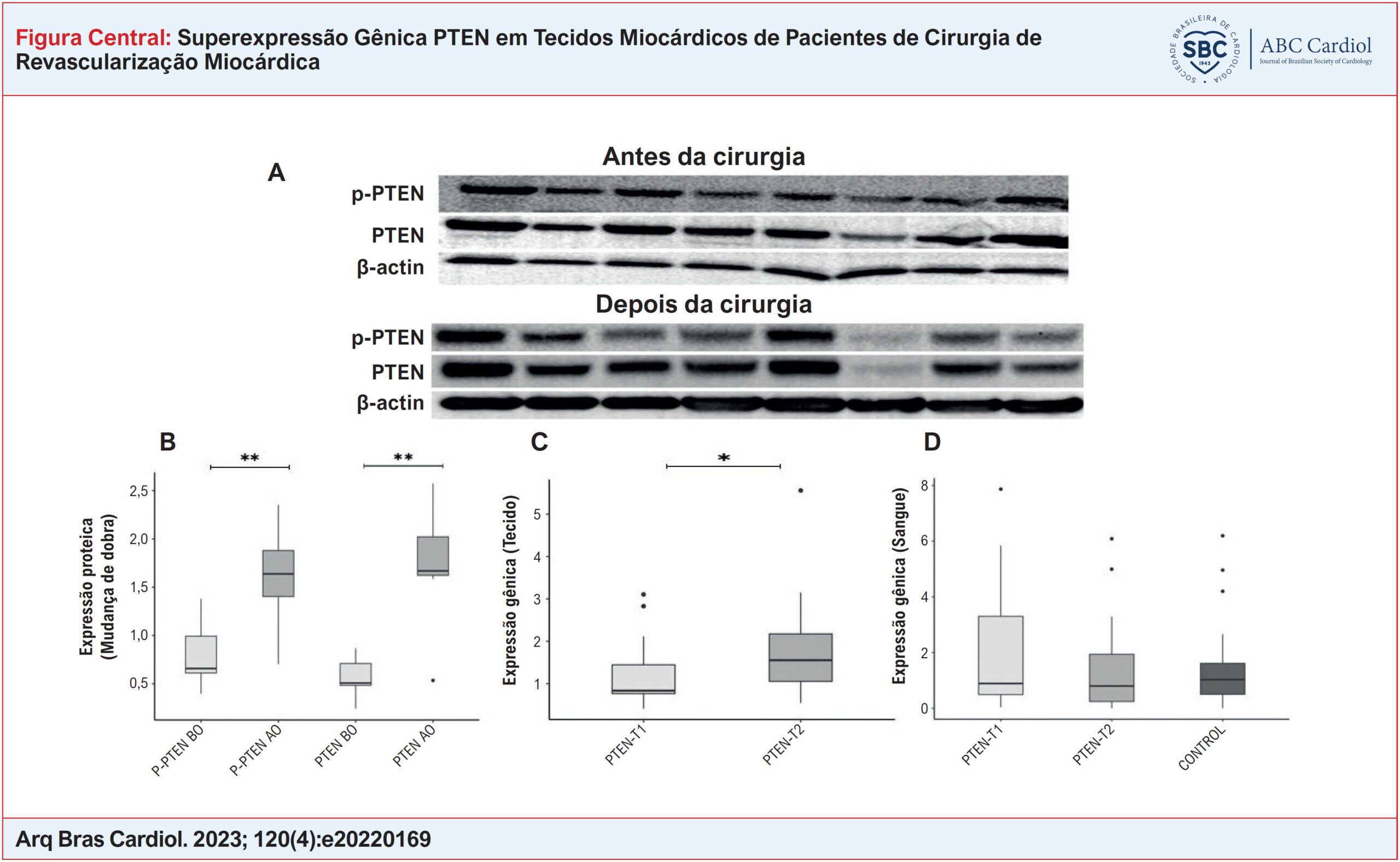 Superexpressão Gênica PTEN em Tecidos Miocárdicos de Pacientes de Cirurgia de Revascularização Miocárdica