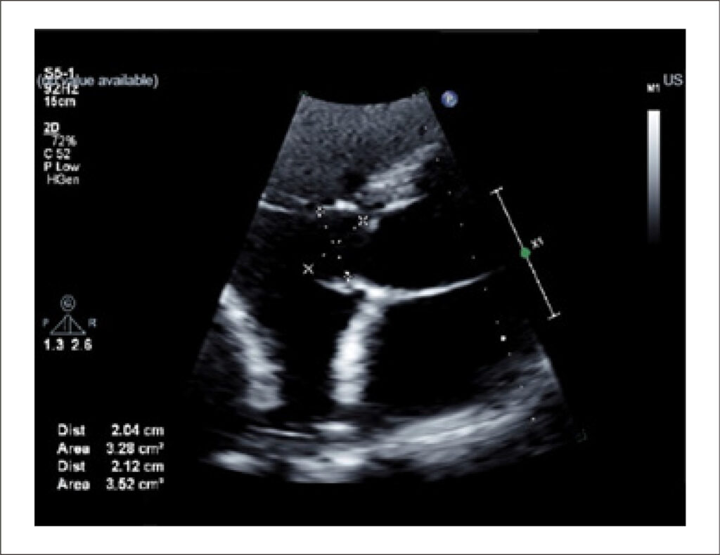Figure 4