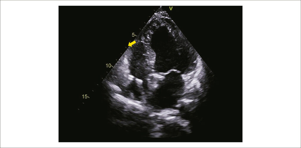 Figura 5