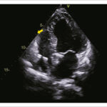 Figura 5
