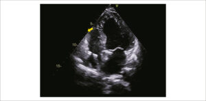 Figura 5