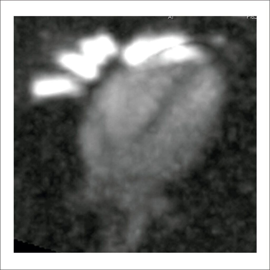 Figura 1