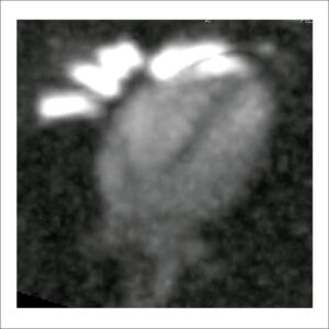 Figura 1