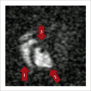 Figura 2