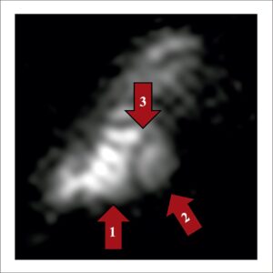Figura 3