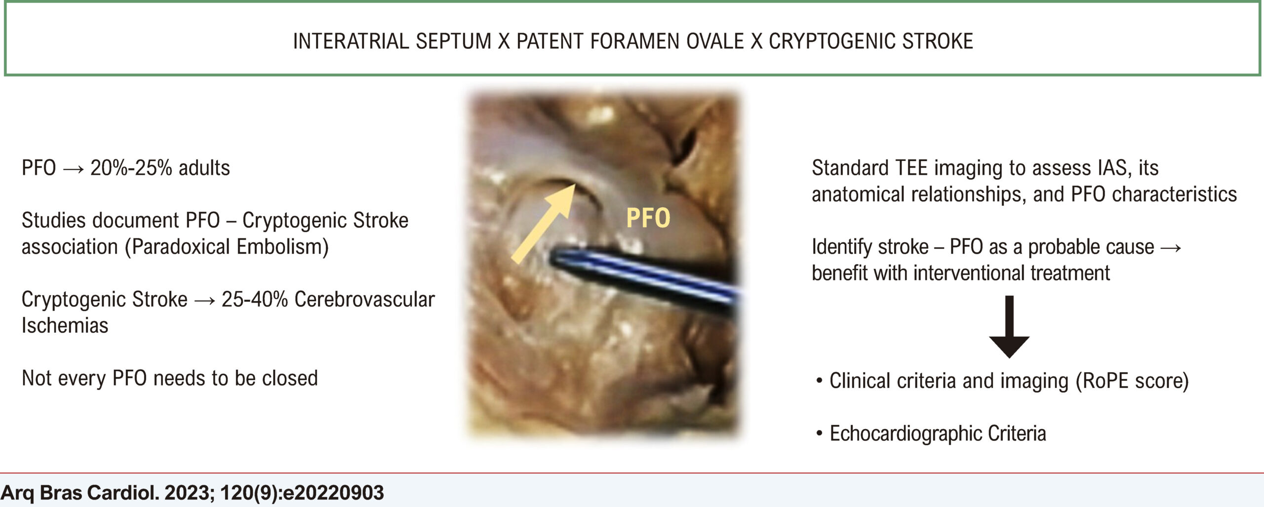 The Role of Echocardiography in the Assessment of the Interatrial Septum and Patent Foramen Ovale as an Emboligenic Source