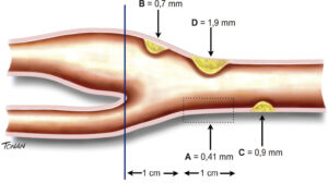 Figura 1