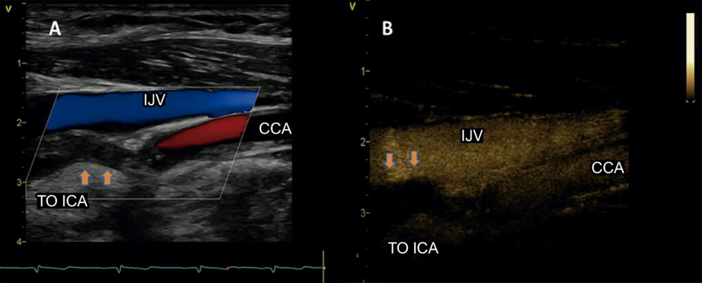 Figure 6