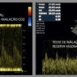 Figura 15
