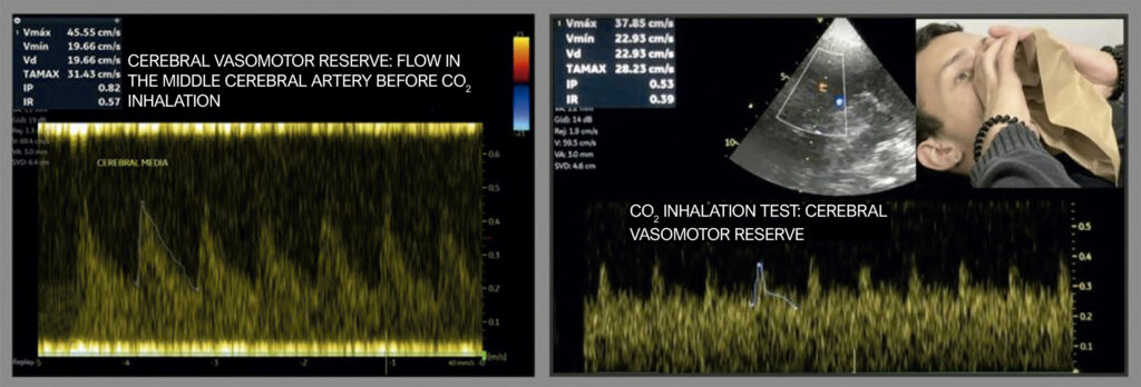 Figure 15