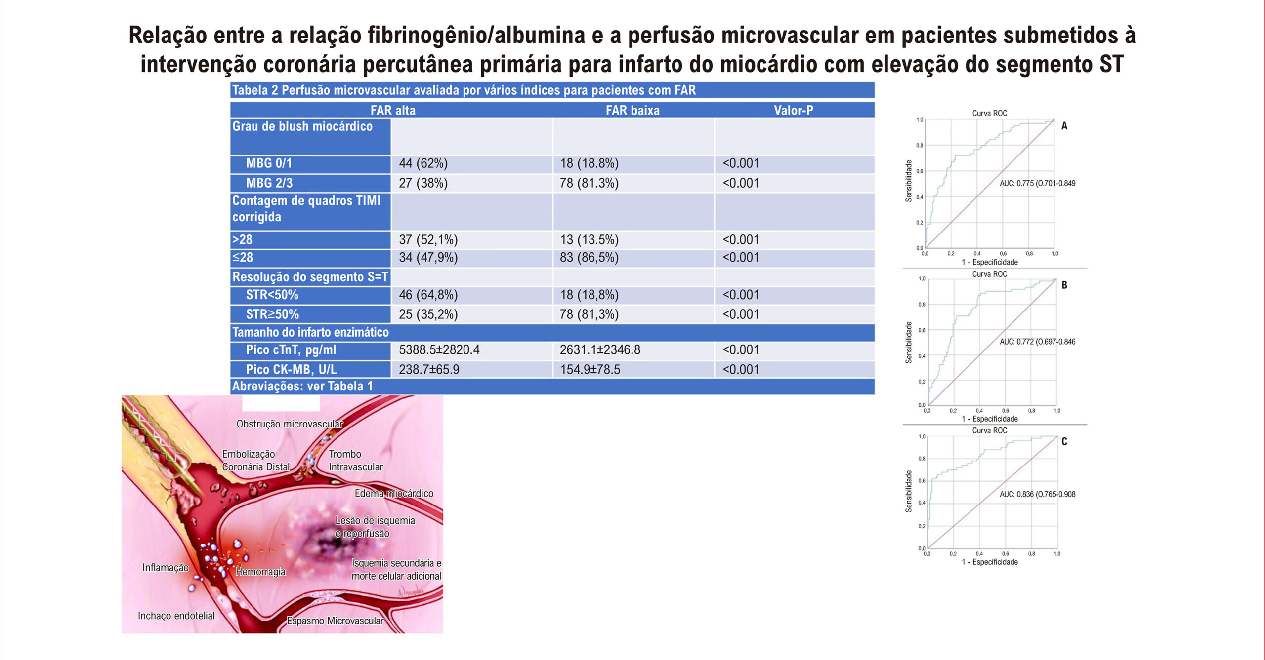 Relação entre a Relação Fibrinogênio/Albumina e a Perfusão Microvascular em Pacientes Submetidos à Intervenção Coronária Percutânea Primária para Infarto do Miocárdio com Elevação do Segmento ST: Um Estudo Prospectivo