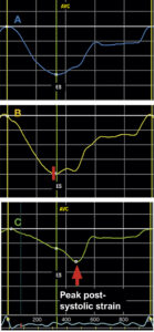 Figure 1.2