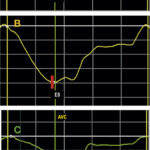Figure 1.2